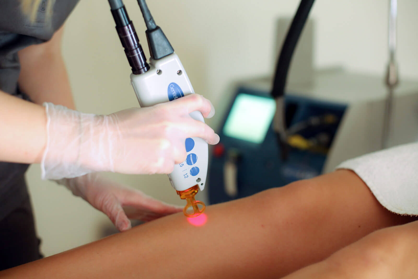 Alexandrite Laze Ne İşe Yarar