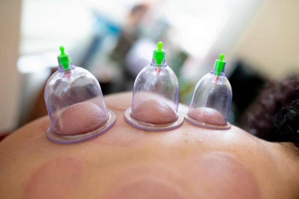 Hacamat Fiyatları 2020